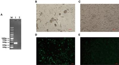 Isolation and Molecular Characteristics of a Novel Recombinant Avian Orthoreovirus From Chickens in China